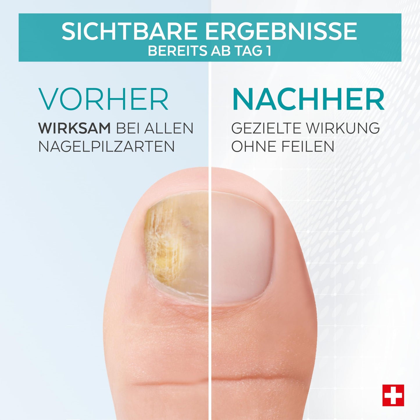 PODERM - Pack of 2 nail fungus treatment serum | Eliminates nail fungus, revitalizes the nails & works from day 1 | 100% Natural with Vitamin E & Lemon | Swiss Made | Developed by a podiatrist - 7640178210110