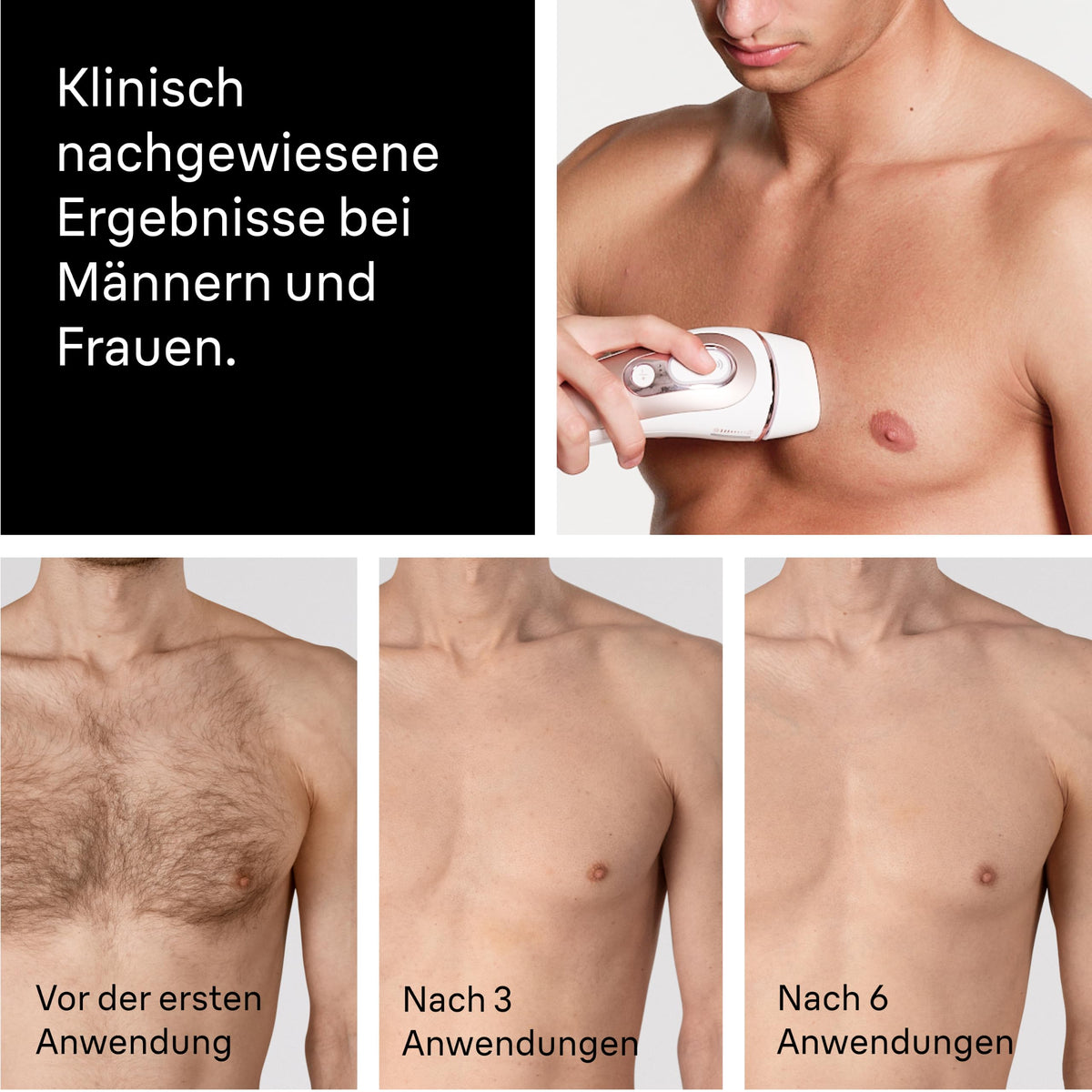 Braun Smart IPL Dispozitive Epilare Skin i·expert 7, PL7263, Rosegold